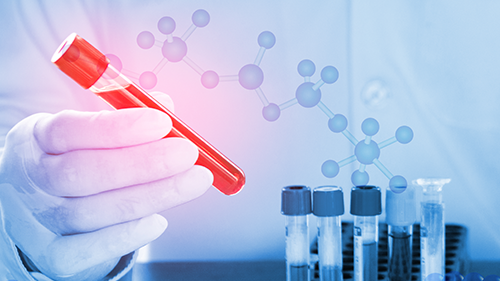 Blood management during the COVID-19 pandemic